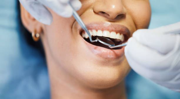 Best Emergency Dental Care for Sports Injuries in Marysville, MI