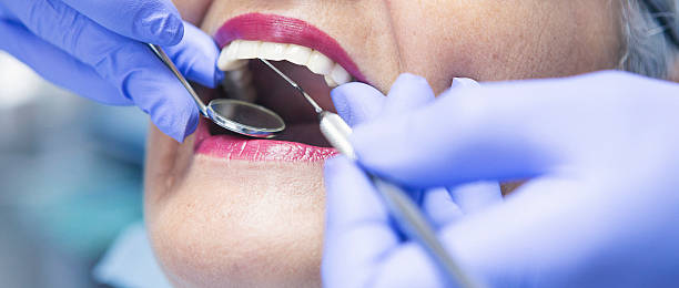 Best Emergency Wisdom Tooth Extraction in Marysville, MI